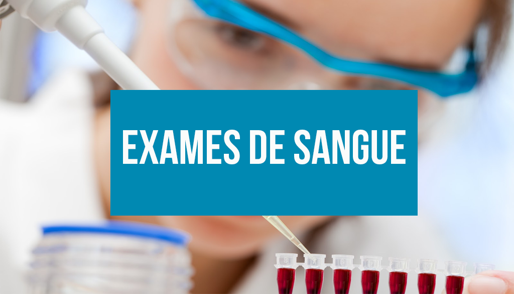 You are currently viewing Exames de sangue