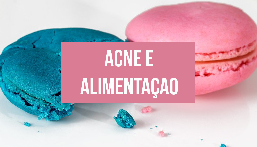 Read more about the article Acne e Alimentação